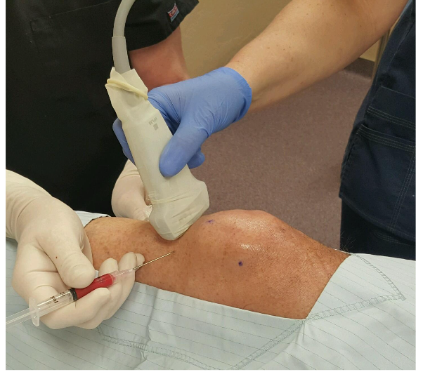 Figure 2: Use of sterile field Ultrasonographic Imaging for diagnostic and therapeutic Targeting of supportive structures