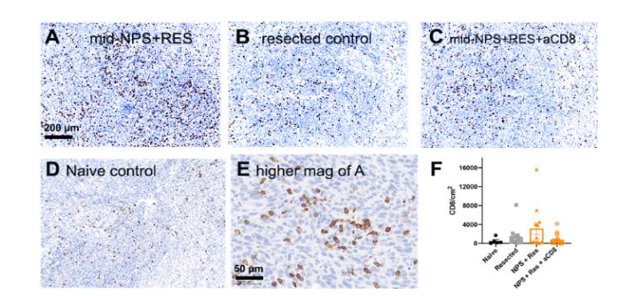 Figure 5. Immunohistochemistry of rechallenge tumors labeled with anti-CD8 antibodies (brown) 30 days postinjection. (A) Rechallenge tumor taken from mouse whose primary tumor was treated with mid-range NPS + resiquimod (RES) injection immediately afterward (15,690 CD8/mm2). (B) Rechallenge tumor taken from mouse whose primary tumor was resected (2140 CD8/mm2). (C) Rechallenge tumor taken from mouse whose primary tumor was treated with mid-range NPS + RES with anti-CD8 antibodies injected IP into the mouse (4140 CD8/mm2). (D) Tumor taken from mouse who did not receive a prior injection of Pan02 cells (Naive) (180 CD8/mm2). (E) Higher magnification of a section from 3A. (F) Plot of the distribution of CD8 densities in four conditions indicated. Error bars represent SEM. (reprinted with permission)