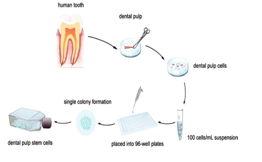 Figure 2: A schematic presentation of stem cell isolation and culture diagram.