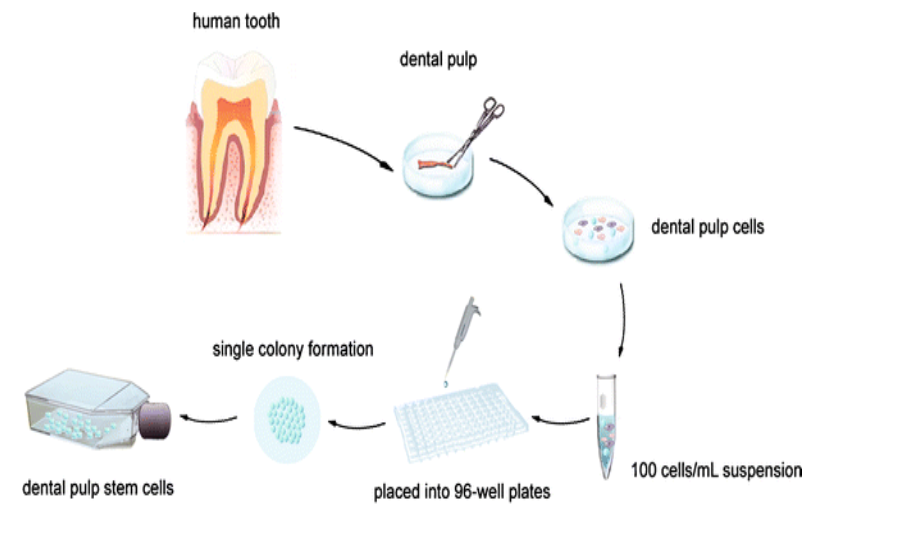 Figure 1: A schematic illustration of Natural Multipotent cells from umbilical cord or tooth gingiva that are capable of proliferating and differentiating into various cell types.