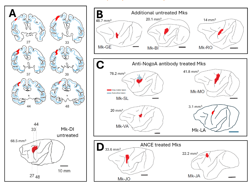 Figure 2: A: For Mk-DI, reconstructions of brain histological sections (50 microns thick; from rostral (27) to caudal (48)), showing the position and extent of the M1 lesion (in red), and aligned together in transparency of a lateral view of the corresponding hemisphere’s surface (bottom drawing). B, C and D: Same lateral views for the other monkeys included in the present study. The volume of the M1 lesion is indicated for each monkey (see also Table 1).