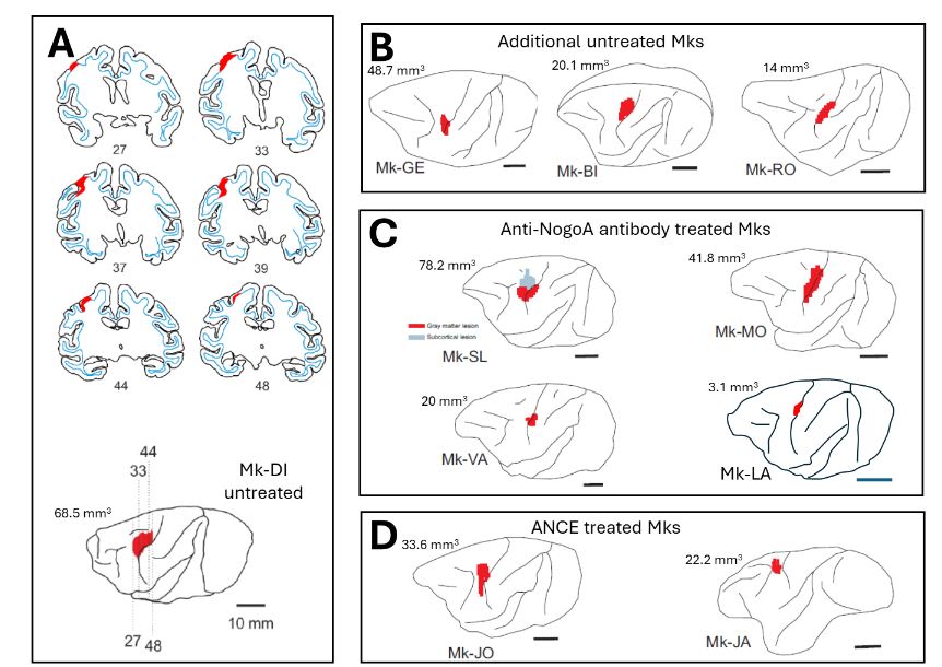 B: Entire “Brinkman Box”, with its upper part (top panel) in the open position.
