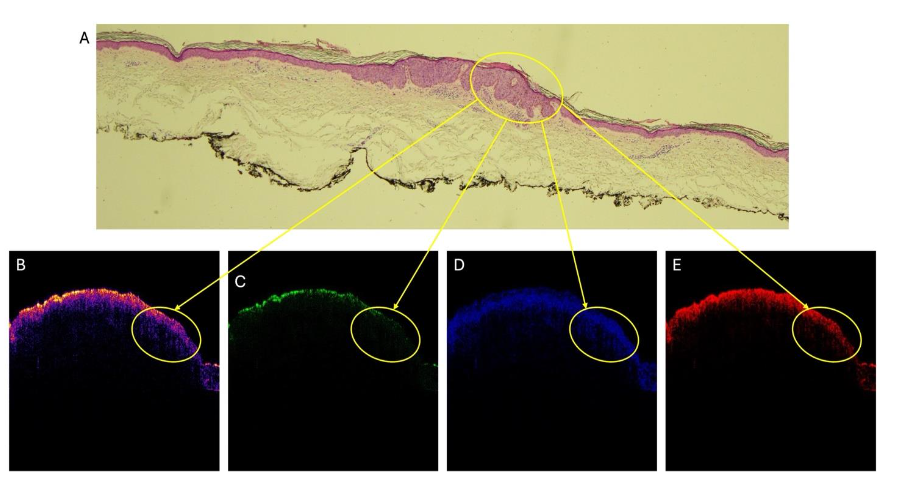Figure 5 shows the OCT color-coded images of the SCC vibrated at 50, 60, 70, and 80 Hz.