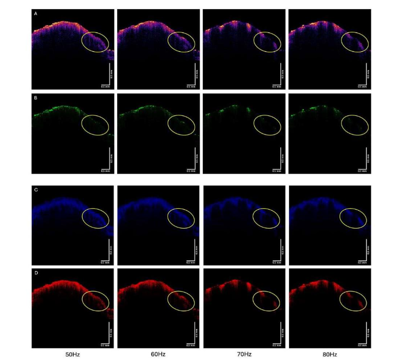 Figure 6. Confusion matrix obtained from a convolutional neural network model used to distinguish SCC (1) from normal skin (0).