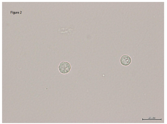Figure 2: Non-stained picture of round cell.