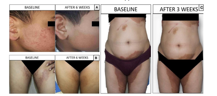 Figure 3. Clinical outcomes with treatment and nutritional supplementation
