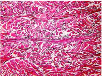 Tight collagen fibers in the dermis, cut perpendicularly to the virtual tension lines. The collagen bundles are held together by fine black elastic fibers, which run horizontally here.