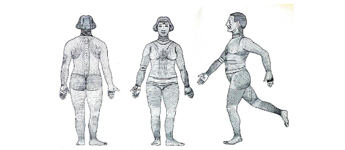 Striae distensae or striae gravidarum are seen in many patients and can often act as a guide in planning elective incisions.