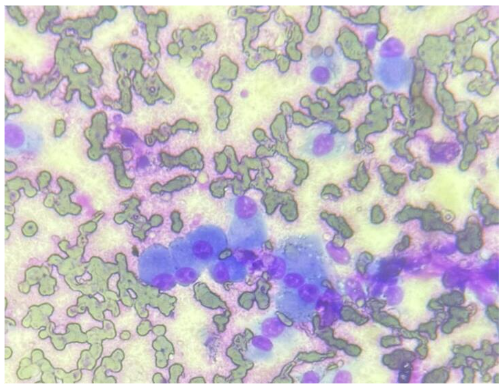 Figure 5: Cytology of Bull Mastiff.
