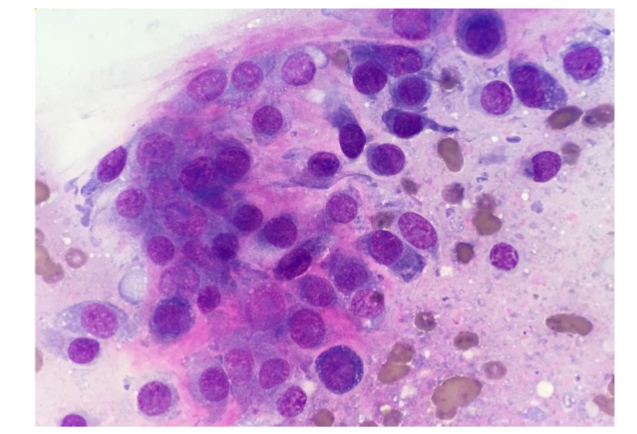 Figure 2: 7-year-old, spayed female, Bull Mastiff, plain lateral radiograph of the right humerus. A lucent area in the bone is present where a bony resorptive reaction (white arrows). Subsequently, fine-needle aspirate biopsy with histopathology from this site confirmed a diagnosis of osteosarcoma.