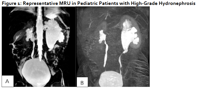 Representative MRU in Pediatric Patients with High-Grade Hydronephrosis
