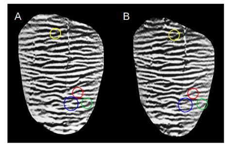 Example of the ambiguity in minutia type identification. Images A and B are results of different photographs from the same tooth. Colored circles highlight similar regions (same color) where the minutia type is subjective.