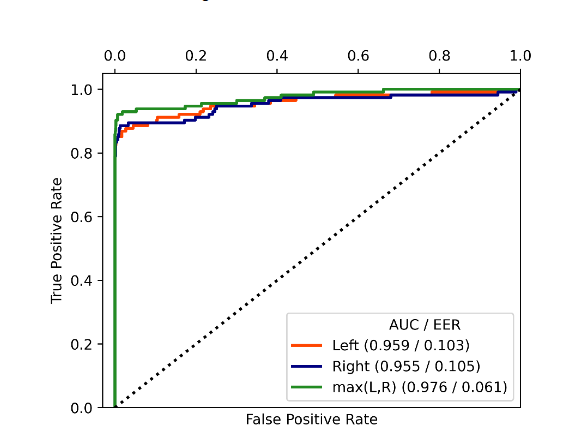 ROC curve of the biometric comparisons of the 115 teeth lighted from the left (L), right (R) and considering both (max (L, R)) sides. AUC is the area under the curve, and EER is the equal error rate in [0,1].