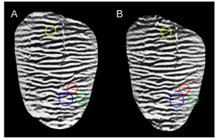 Figure 5. Example of the ambiguity in minutia type identification. Images A and B are results of different photographs from the same tooth. Colored circles highlight similar regions (same color) where the minutia type is subjective.