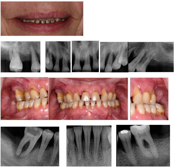 BEFORE Treatment, 2019