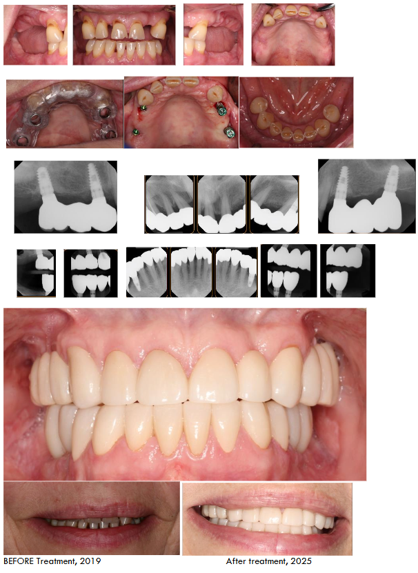 After treatment, 2025