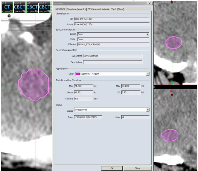 Pixel information of Volume of interest (VOI). It was directly application of the property function of VOI from contouring module from Eclipse Treatment Planning System from Varian Medical System.