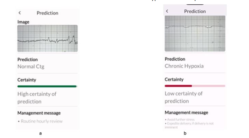 Features of acute hypoxia (a) and the ZigZag pattern (b), which were correctly identified by all the experts and TMA.