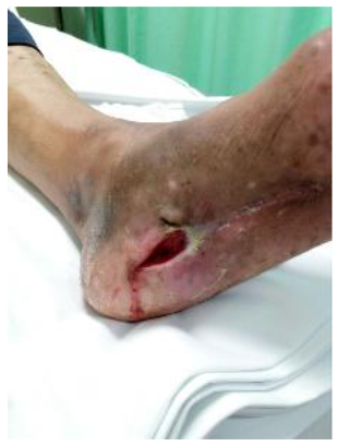 Male patient, 37 y.o., DM2 treated elsewhere initially.