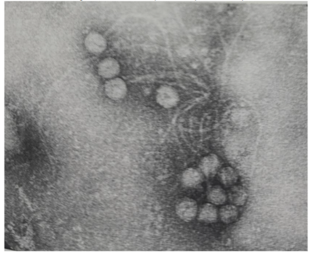 The electron micrograph showing clusters of Streptococcus thermophilus ST-2 Bacteriophages in the Phage Lysate.