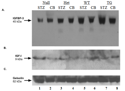 Glomerular analysis of non-diabetic and diabetic null, heterozygous, wild-type, and HB-EGF transgenic mice. A. Masson’s trichrome staining of CB- and STZ-treated null, heterozygous, wild-type, and HB-EGF transgenic mice (representation of 5 glomeruli of 5 different mice each). B. Mean number of glomerular nuclei per glomeruli area from CB- and STZ-treated null, heterozygous, wild-type, and HB-EGF transgenic mice (representation of 5 glomeruli of 5 different mice each). Data were analyzed by Student’s T-test. * p< 0.05.