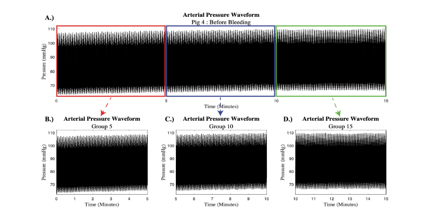 Figure 1: Arterial Pressure Signal: A.) The full 15-minute arterial pressure signal split into three 5-minute signals corresponding to: B.) the first 5 minutes (Group 5, red box), C.) the second 5 minutes (Group 10, blue box), and D.) the last 5-minutes of the 15-minute signal (Group 15, green box).