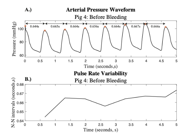 Figure 2: Selected Arterial Pressure Waveform: A.) The arterial pressure waveform from subject 4 prior to hemorrhage with the time (in seconds, s) between beats indicated. B.) The corresponding PRV signal derived from the pulse intervals labeled in A.).