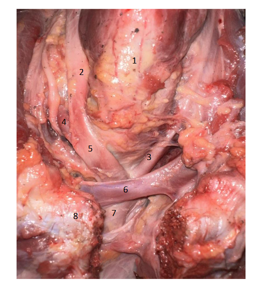 Image - Left Brachiocephalic vein and Brachiocephalic artery in a cadaver. 1. Trachea 2. Right common carotid 3. Left common carotid 4. Right subclavian artery 5. Brachiocephalic artery 6. Left brachiocephalic vein 7. Aorta 8. Sternum