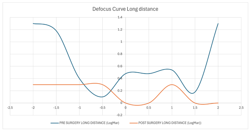 Figure 5. Defocus curve for long-distance vision, showing preoperative (blue) and postoperative (orange) LogMAR values. The postoperative curve demonstrates improved visual acuity and extended range of focus.