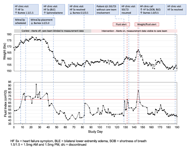 Figure 5 tracks this patient’s weight and fluid index through a noninvasive measurement with the BodyPort cardiac scale. Alarms for overload were enabled during the second half of the trial. Following a long period of euvolemia after MitraClip placement, the patient independently discontinued SGLT-2 therapy, triggering an alarm for an increased fluid index. Patient’s cardiologist was able to adjust outpatient GDMT based on BodyPort readings to prevent hospitalization for decompensated heart failure exacerbation.