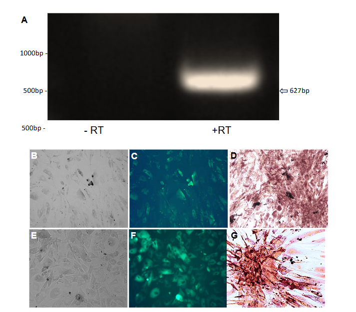 Figure 1. ADAM 12S Infection Induces Endogenous HB-EGF in Human Primary Preadipocytes.