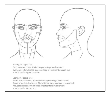 AASI score for Alopecia Areata