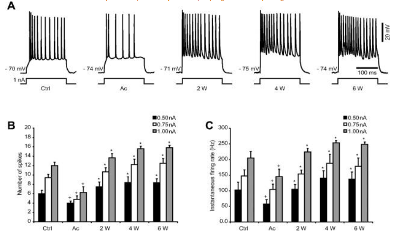 Figure 6: Progressive increase in neuronal excitability after cortical undercut.