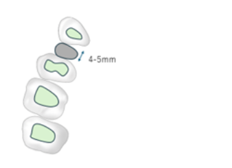 The bisected diagram shows the roots of the bicuspids, along with the adjacent roots of the second bicuspids and the canine, which nearly touch each other.