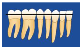 The arch can be easily leveled when there is no extraction.