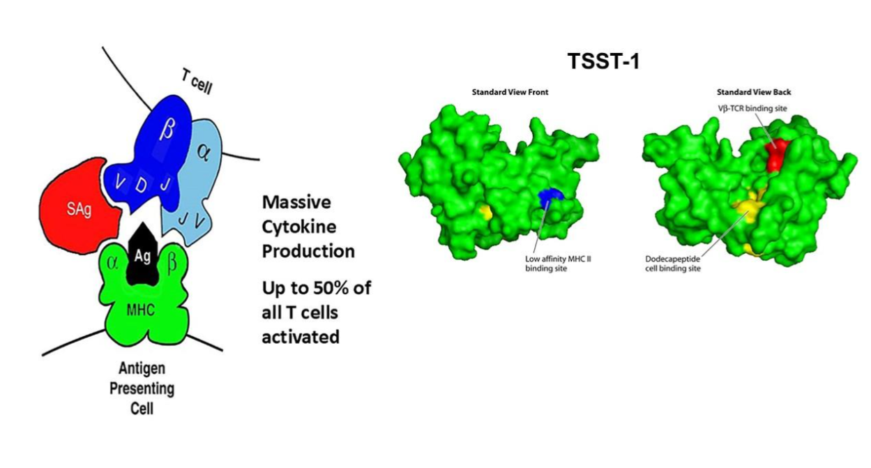 Figure 1 Legend. Left side: Superantigen (SAg) interaction with the β-chain of the T lymphocyte receptor with the α-chain of the major histocompatibility complex (MHC) II molecule on antigen (Ag) presenting cells, in this case macrophages. Ag is the typical antigenic peptide present within the groove of T cell receptor and MHC II, leading to activation of 1/10,000 T cells. Right side: The three-dimensional structure of the superantigen toxic shock syndrome toxin-1 (TSST-1) in the standard front view and standard back view. The red region of TSST-1 are some amino acids that interact with the β-chain of the T cell receptor; the blue region of TSST-1 are some amino acid residues that interact with MHC II; the yellow region (called dodecapeptide) are some amino acids that interact with the immune co-stimulatory molecule CD40 on epithelial cells and keratinocytes. Note that TSST-1, SEB, and SEC contain only a low affinity MHC II binding site on macrophages. Some superantigens, including SEA, SED, SEE, SEG, and the SEl superantigens have both low affinity and high affinity MHC II sites. The low affinity site of all superantigens is as shown. The high affinity site (10X higher affinity) is in the groove on the left side of superantigens in the standard front view.