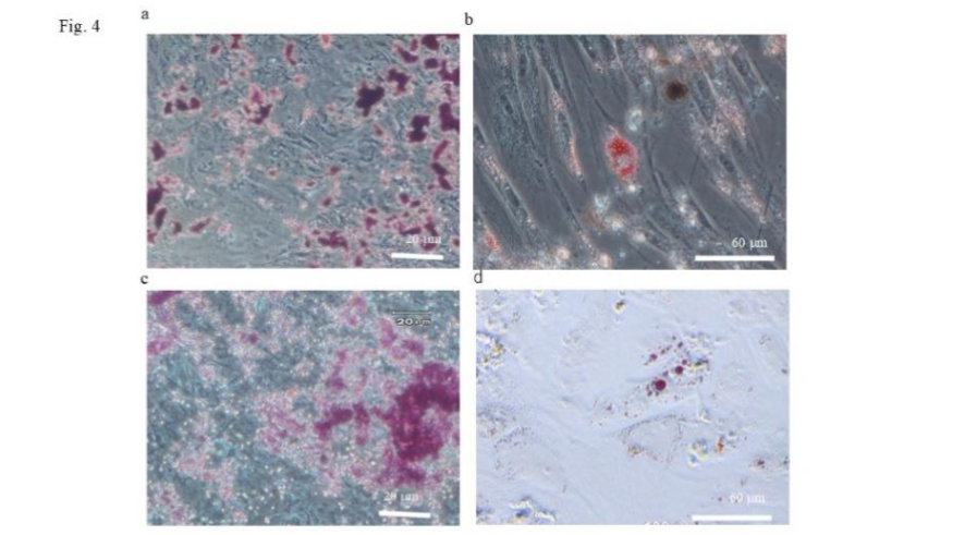 Assessment of the osteoblastic- and adipogenic-differentiation potential of umbilical cord-derived mesenchymal stem cells (UC-MSCs) and cryopreserved-UC-MSCs (cUC-MSCs).