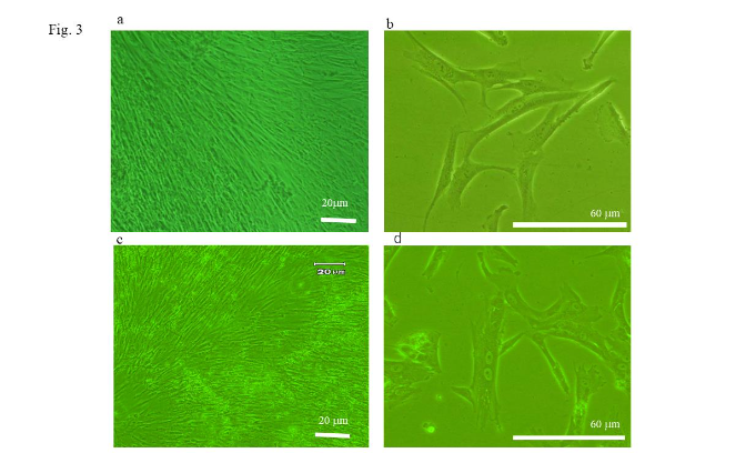Figure 4. Assessment of the osteoblastic- and adipogenic-differentiation potential of umbilical cord-derived mesenchymal stem cells (UC-MSCs) and cryopreserved-UC-MSCs (cUC-MSCs). (a) Staining with alizarin red. The samples of UC-MSCs, which had been induced to differentiation into osteoblasts, were stained extracellularly and diffusely with alizarin red. (b) Staining with oil red. The samples of UC-MSCs, which had been induced to differentiation into adipose cells, showed intracellular lipid droplets that were stained with oil red (arrow). (c) Staining with alizarin red. The samples of cUC-MSCs, which had been induced to differentiation into osteoblasts, were stained extracellularly and diffusely with alizarin red. (d) Staining with oil red. The samples of cUC-MSCs, which had been induced to differentiation into adipose cells, showed intracellular lipid droplets that were stained with oil red (arrow).