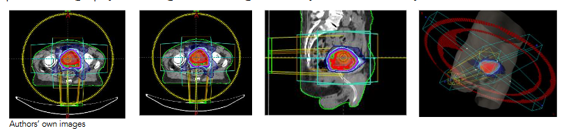 Figure 2, Treatment plan dose delivery pattern selected for this study.