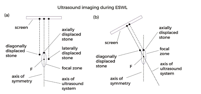 Superposition of the graphs shown in (a) and (b), using a different time scale.