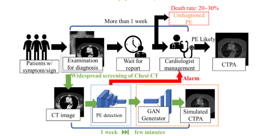 Simulated CTPA Images for Pulmonary Embolism Diagnosis - European ...