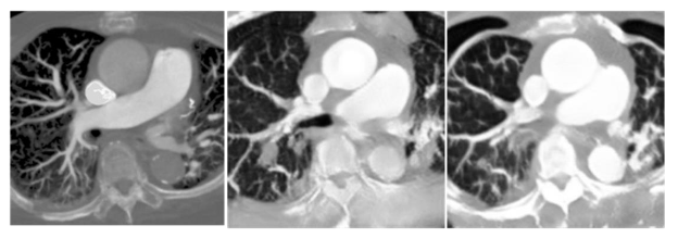 Figure 13. Comparison of the output image with different depths of the discriminators. The left image is the original image, the middle image is the result of training the discriminator with three layers of depth, and the right image is the result of training the discriminator with four layers of depth.