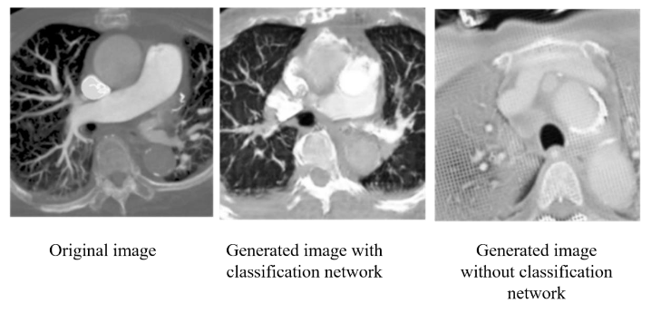 Figure 11. Comparison of the output image with categorization network. The left is the original image, the middle is the result of adding classification network to the analog generation network, and the right is the result of the analog generation network without classification network.