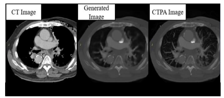 Figure 7. Simulated images generated by CTPA_Pix2pix model