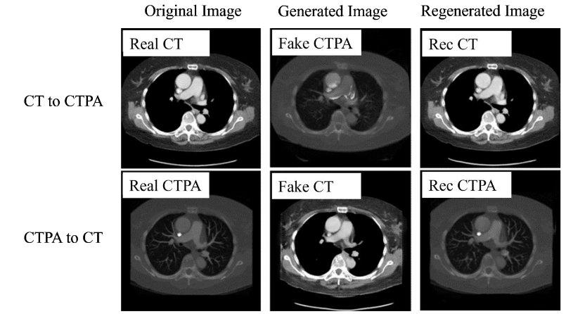Figure 9. Simulated images generated by CTPA_CycleGAN model (ResNet)