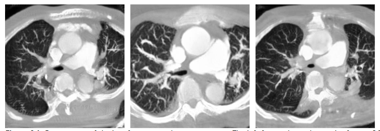 Figure 14. Comparison of the loss function on the output image. The left figure shows the result of using BCE loss with L1 loss, the middle figure shows the result of BCE loss with SSIM, and the right figure shows the result of MSE loss with SSIM.