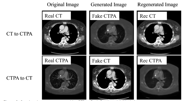 Figure 8. Simulated images generated by CTPA_CycleGAN model (U-Net)