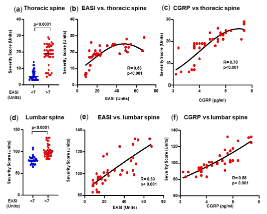 Figure 3. Thoracic spine and lumbar spine.