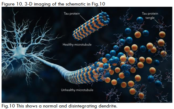 Figure 11. An image of a BB biofilm with Chlamydia pneumoniae (CP) noted in its center.
