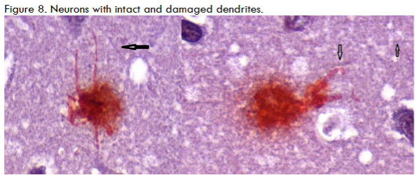 Figure 9. Schematic of dendrite microtubule disruption.